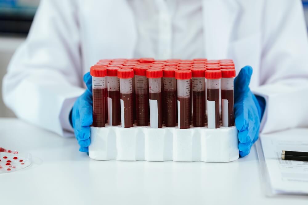 pobranie krwi w domu